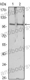 Western blot for Anti-HDAC4 Antibody (R3N54) ?>