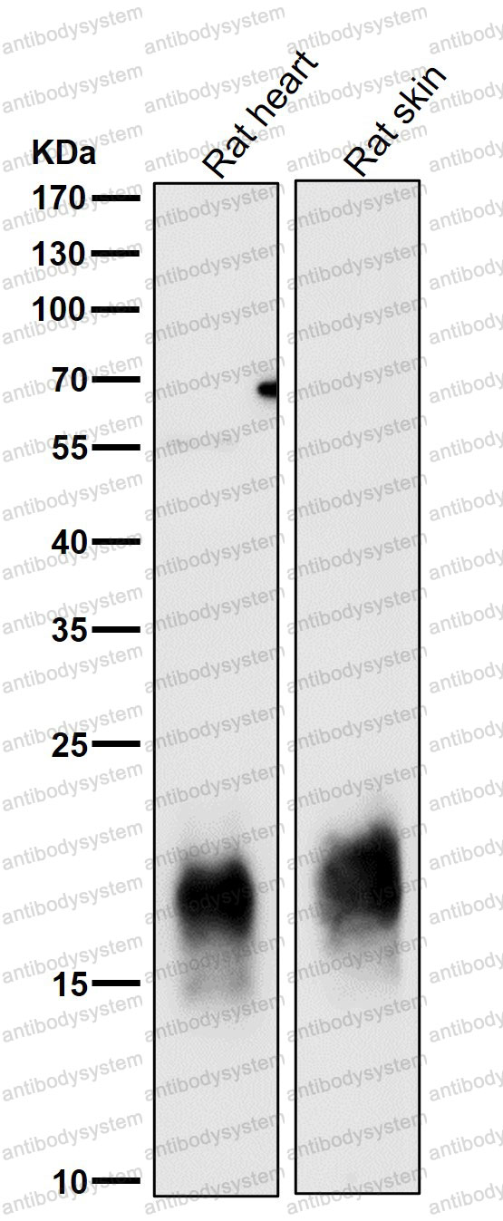 Anti-CAV3/Caveolin-3 Antibody (R1A14)