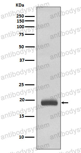 Anti-CAV3/Caveolin-3 Antibody (R1A15)