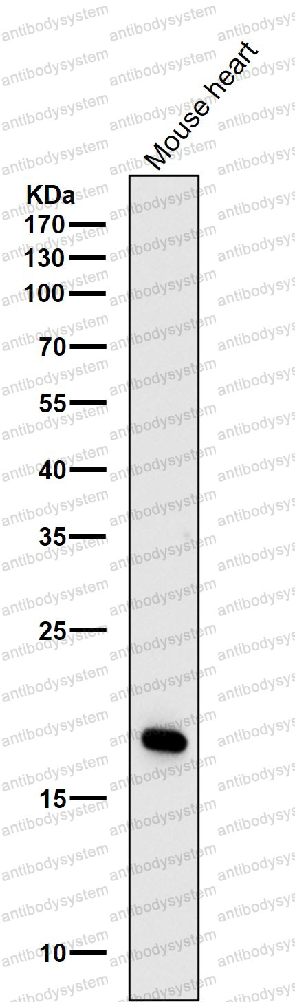 Anti-CAV3 Antibody (R1Z48)