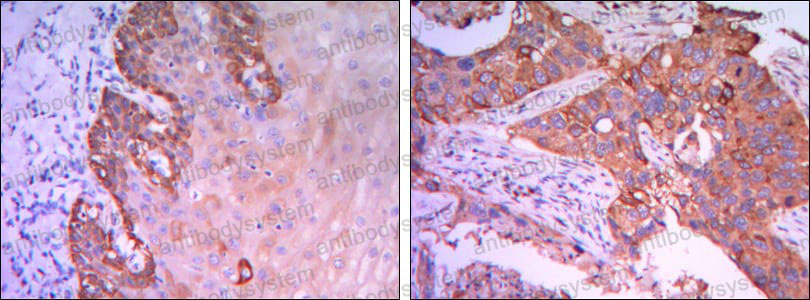 Immunohistochemical for Anti-RAB25 Antibody (R3N70) ?>