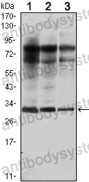 Western blot for Anti-RAB25 Antibody (R3N70) ?>