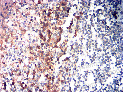 Immunohistochemical for Anti-CD85g/LILRA4/ILT7 Antibody (R3N73) ?>
