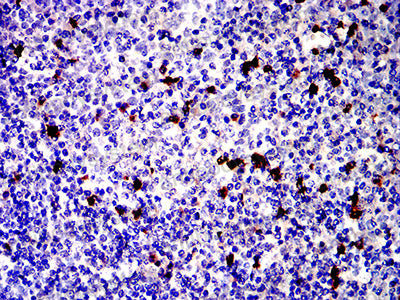 Immunohistochemical for Anti-CD81 Antibody (R3N75) ?>