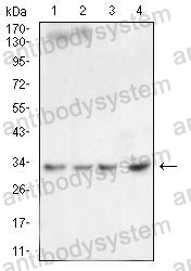 Western blot for Anti-CD81 Antibody (R3N75) ?>