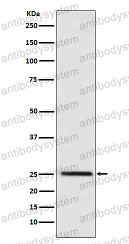 Anti-TPI1 Antibody (R1Z71)