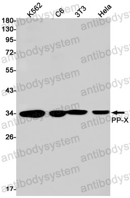 Anti-PPP4C Antibody (R1Z74)