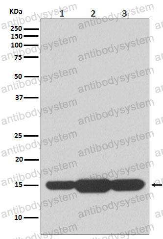 Anti-GABARAPL2 Antibody (R1Z75)