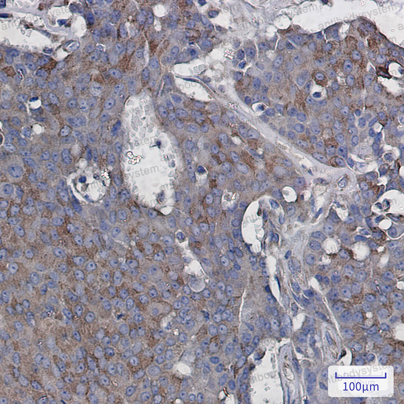 Anti-RAC3 Antibody (R1Z78)