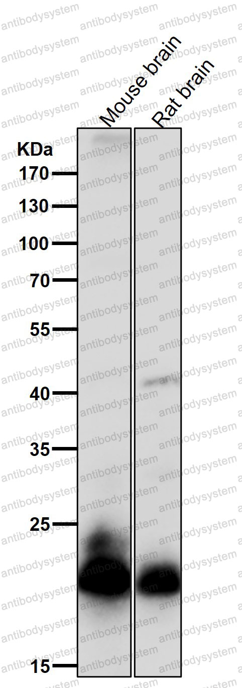 Anti-RAC3 Antibody (R1Z77)