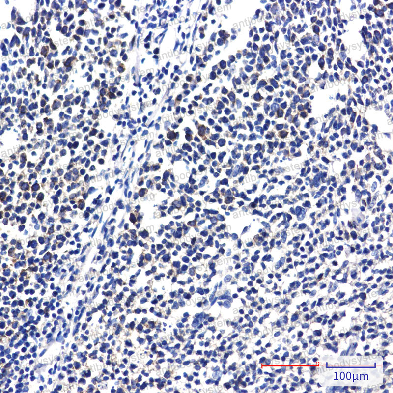 Anti-RPS20 Antibody (R1Z82)