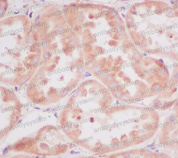 Anti-RPS20 Antibody (R1Z81)