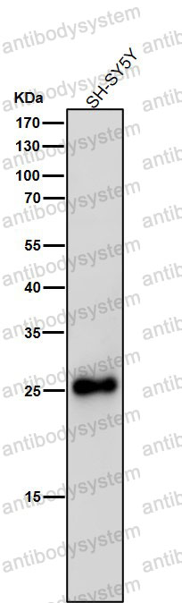 Anti-SNAP25 Antibody (R1Z84)