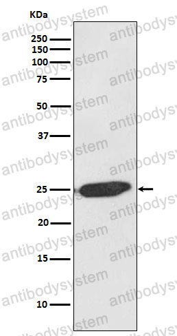 Anti-SNAP25 Antibody (R1Z83)