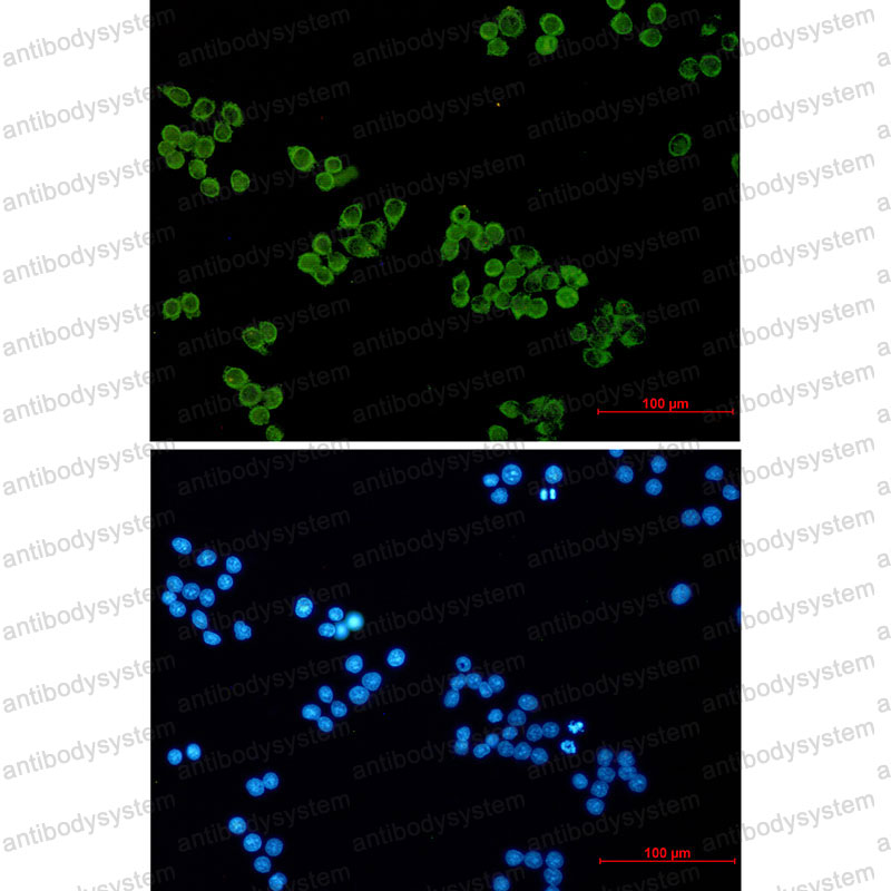 Anti-SNAP25 Antibody (R1Z85)