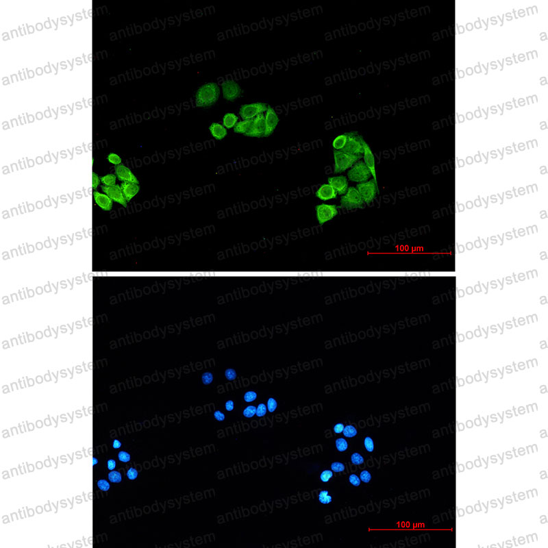 Anti-PSMA6 Antibody (R1Z86)