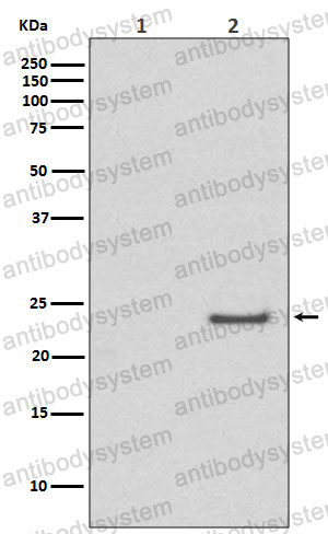 Anti-Phospho-CDC42 (Ser71) Antibody (R1Z87)