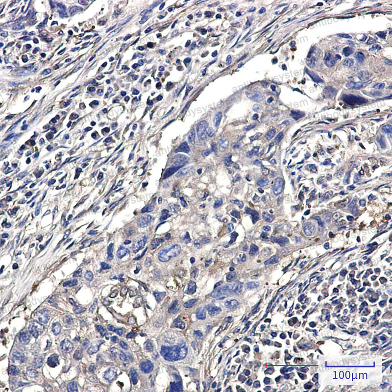 Anti-DSTN Antibody (R1Z90)