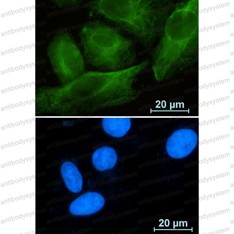 Anti-RAB10 Antibody (R1Z93)