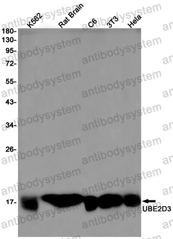 Anti-UBE2D3 Antibody (R1Z94)