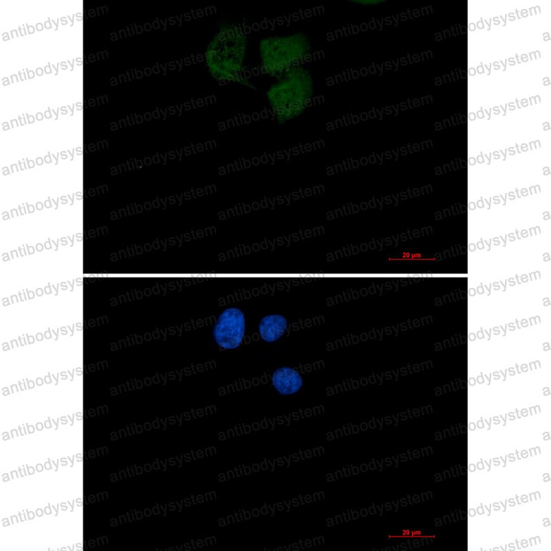 Anti-UBE2N Antibody (R1Z96)
