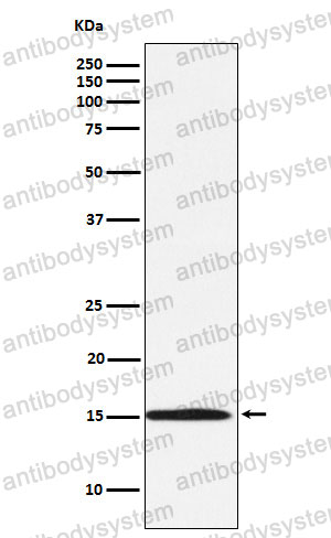 Anti-Ube2N/Ubc13 Antibody (R1Z95)