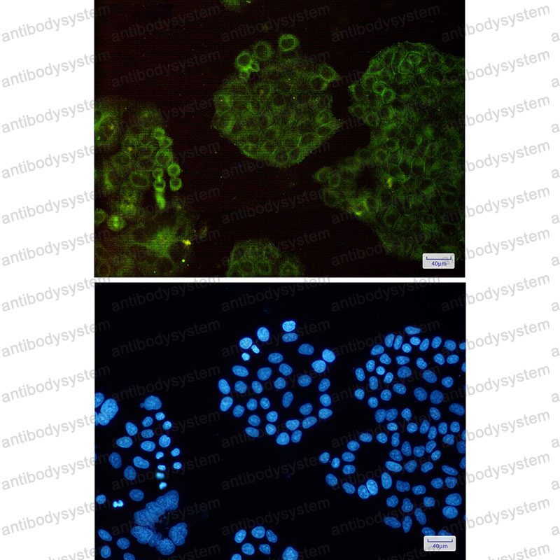 Anti-ACTR3 Antibody (R1Z97)
