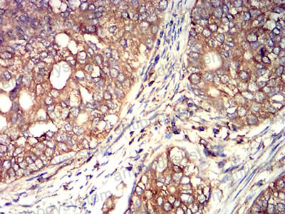 Immunohistochemical for Anti-ACTR3 Antibody (R3N87) ?>