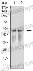Western blot for Anti-ACTR3 Antibody (R3N87) ?>