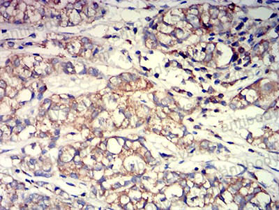 Immunohistochemical for Anti-ACTR3 Antibody (R3N88) ?>