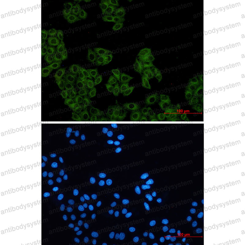 Anti-ACTR2 Antibody (R1Z99)