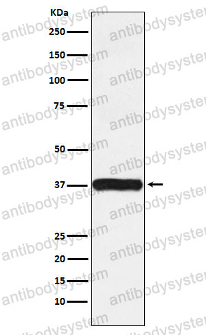 Anti-ACTR2 Antibody (R1Z98)