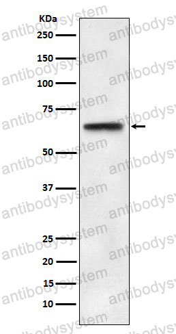 Anti-ABCE1 Antibody (R2A01)