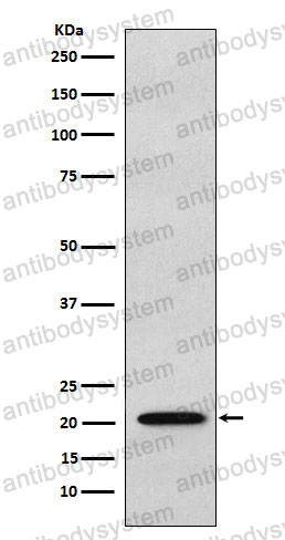 Anti-RAP1A/1B Antibody (R2A03)