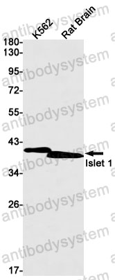 Anti-ISL1 Antibody (R2A07)