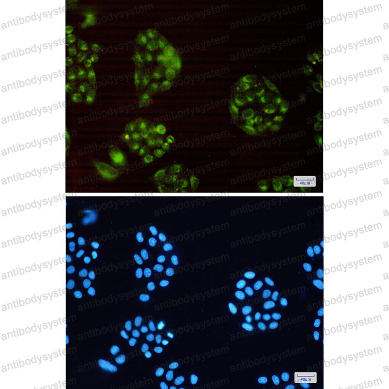 Anti-ATP6V0D1 Antibody (R2A08)