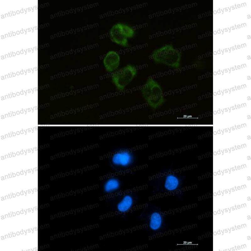 Anti-LYZ Antibody (R2A13)