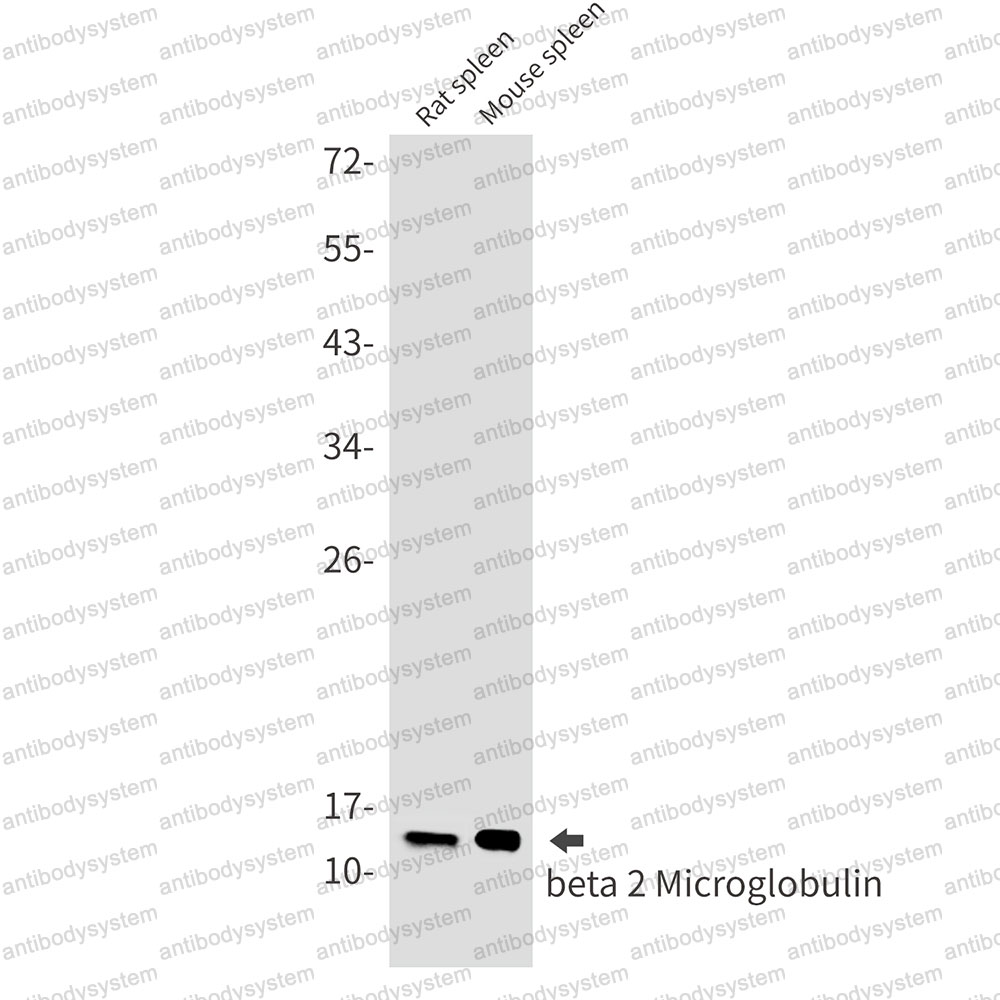 Anti-B2M/Beta-2-microglobulin Antibody (R2A16)