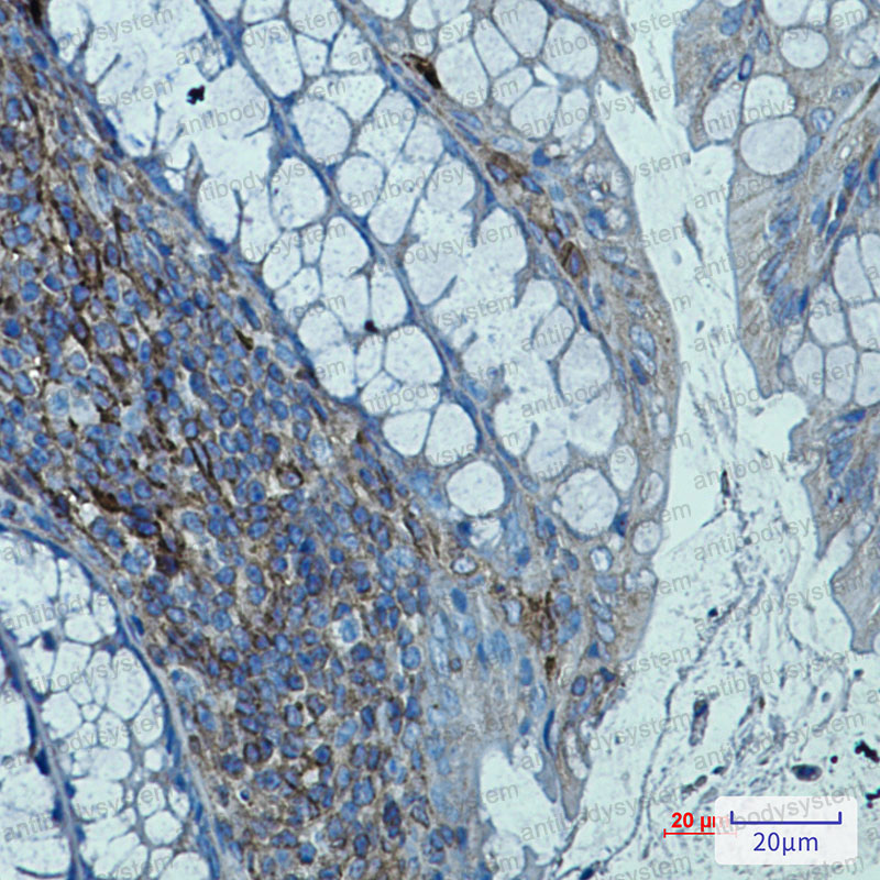 Anti-B2M/Beta-2-microglobulin Antibody (R2A17)