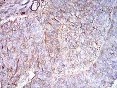 Immunohistochemical for Anti-B2M/Beta-2-microglobulin Antibody (R3N96) ?>