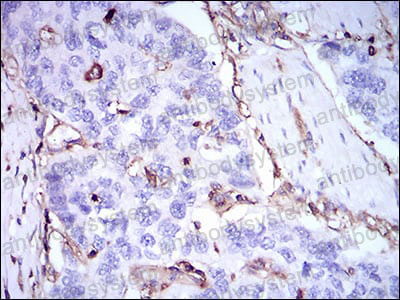 Immunohistochemical for Anti-B2M/Beta-2-microglobulin Antibody (R3N96) ?>