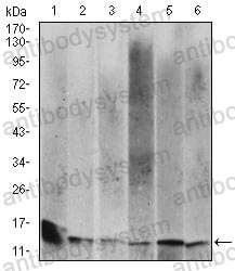 Western blot for Anti-B2M/Beta-2-microglobulin Antibody (R3N96) ?>