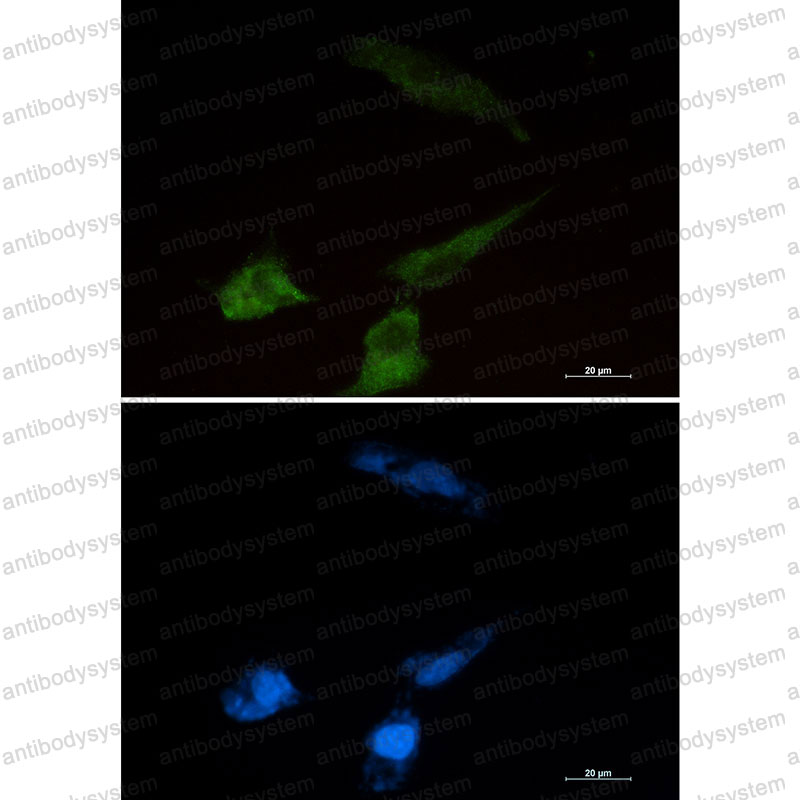 Anti-NPC2 Antibody (R2A19)
