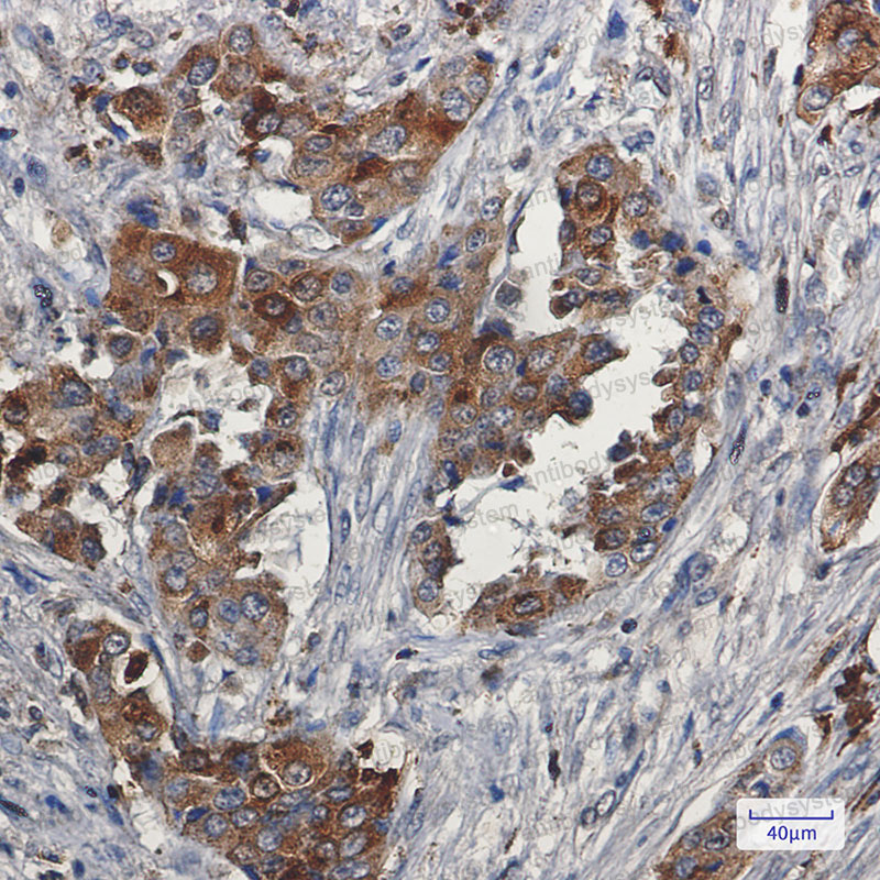 Anti-NPC2 Antibody (R2A18)