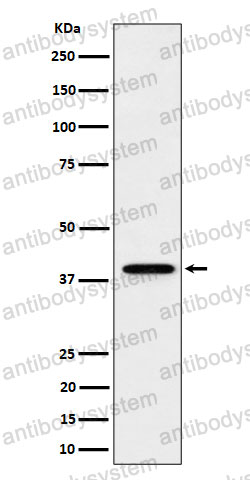 Anti-DCAF7 Antibody (R2A23)