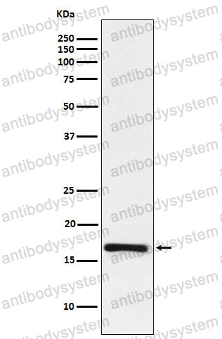 Anti-LMO4 Antibody (R2A25)