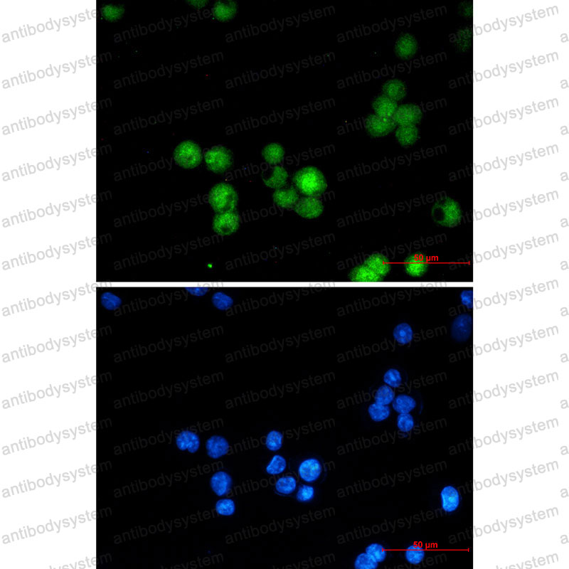 Anti-HNRNPK Antibody (R2A27)