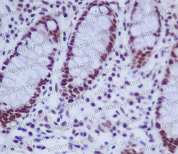 Anti-HNRNPK Antibody (R2A26)