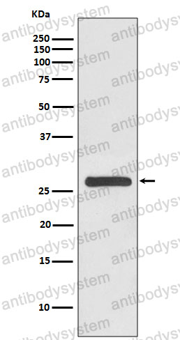 Anti-YWHAG Antibody (R2A28)