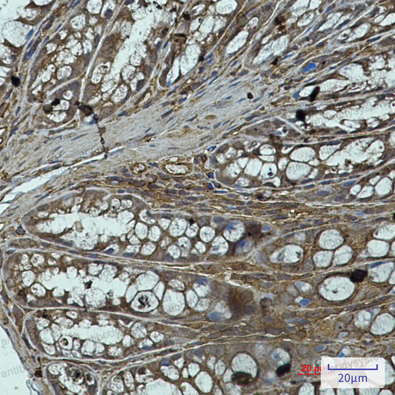 Anti-PP1C alpha/beta Antibody (R2A30)